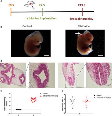 Ethionine Suppresses Mitochondria Autophagy and Induces Apoptosis via Activation of Reactive Oxygen Species in Neural Tube Defects